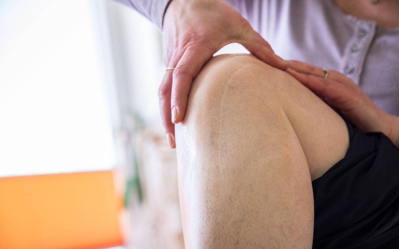 Eine Frau massiert eine Operationsnarbe am Knie