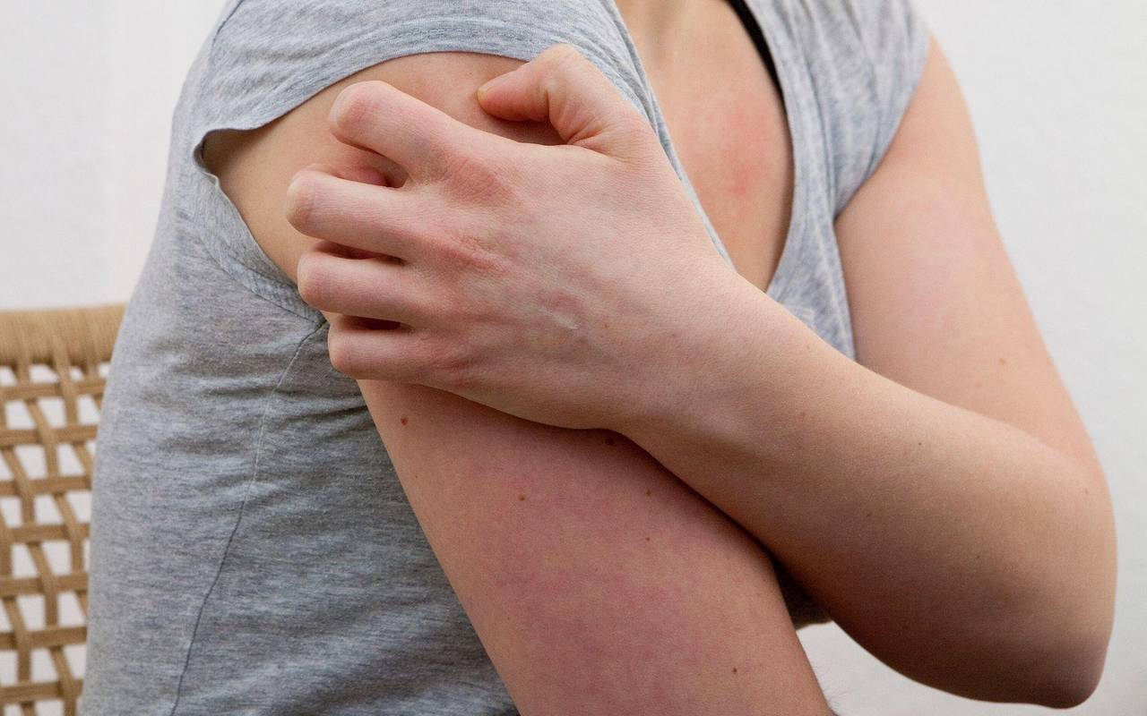 Eine Frau kratz sich am Oberarm