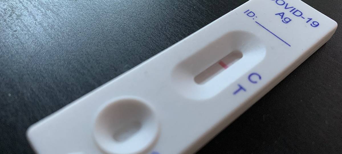Gesundheitsamt begrüßt Ende kostenloser Schnelltests