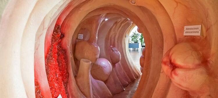 Leverkusen: Begehbarer Darm in der Rathaus-Galerie